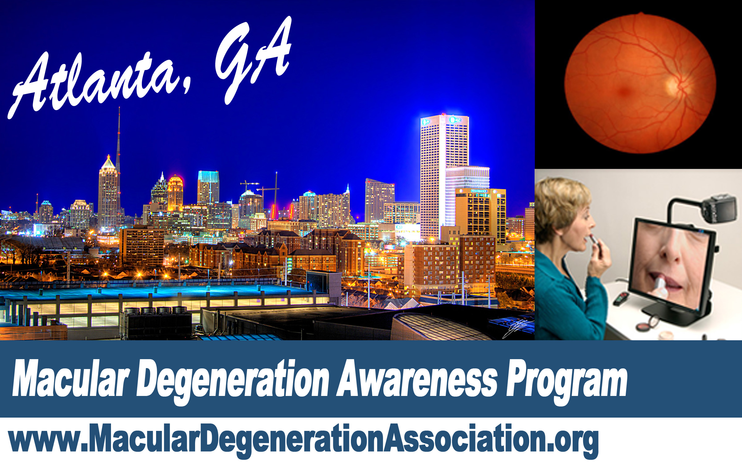 macular degeneration awareness program Atlanta Macular Degeneration awareness program Atlanta