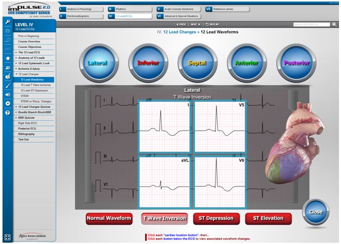 ecg on series 4